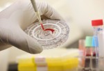 Berlin Hospital Prepares For Possible Ebola Cases